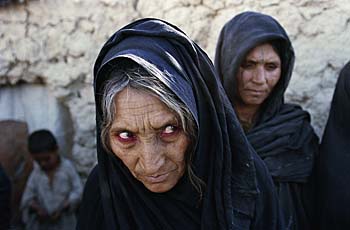 Une refugiée Afghane à Quetta au Pakistan. Fevrier 2001.