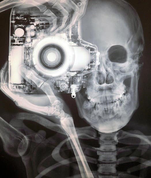 Un photographe et son Nikon passés aux rayons X